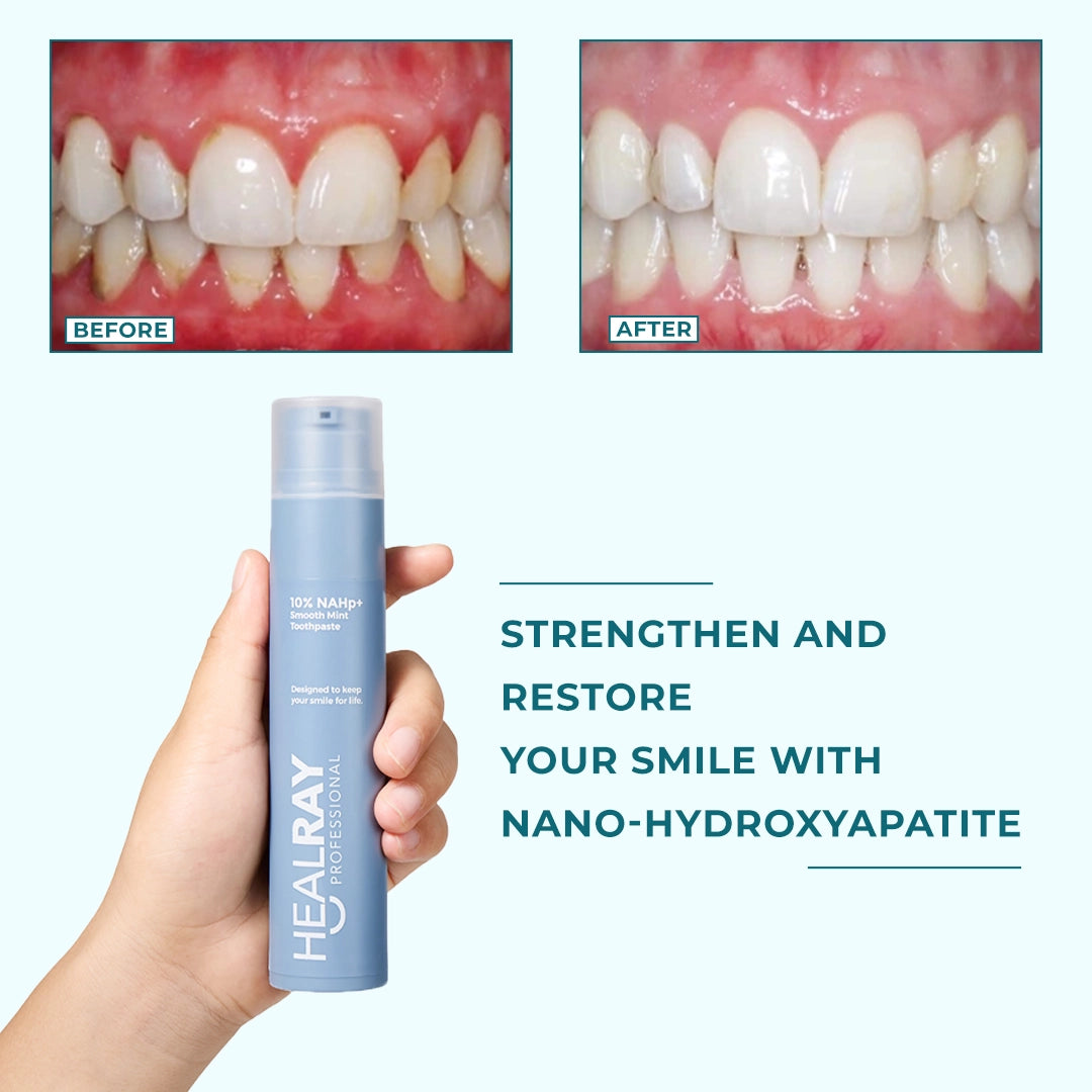 10% Hydroxyapatite Oral Health Toothpaste